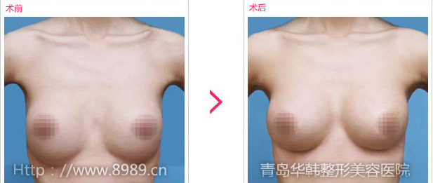 C鷿´ǰЧ
