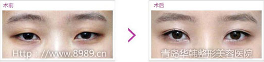 Cϲ´ǰЧ(du)