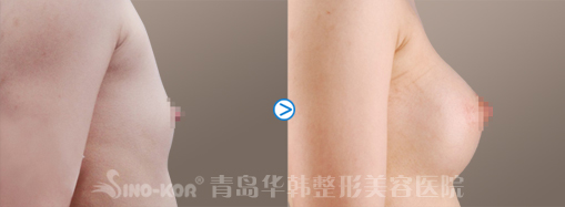 Sǰ(du)ȈD