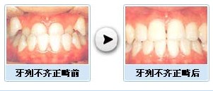 XCЧD