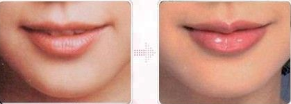 ȥyǰЧ(du)