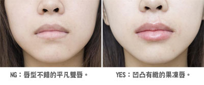 촽ǰЧ(du)