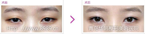 ϲ´pƤǰЧ(du)
