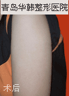 ݸ첲