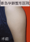 ݸ첲ǰ