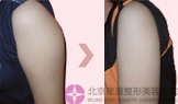 AnB(ti)֬ᘌ(du)ȈD
